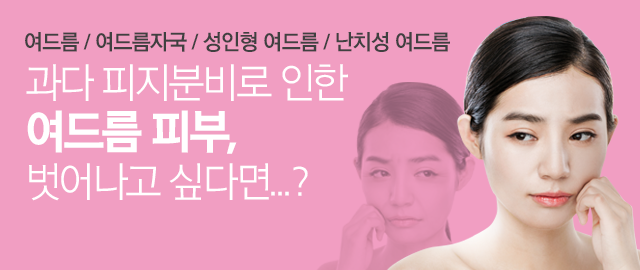 요로결석 안내 4